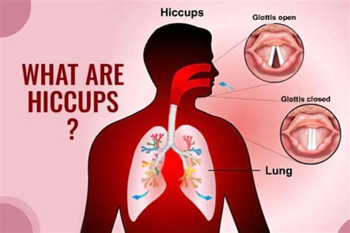 Do we hiccup because we used to be fish?