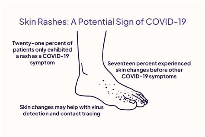 Does Covid make your skin hurt?