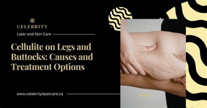 Does lemon reduce cellulite?