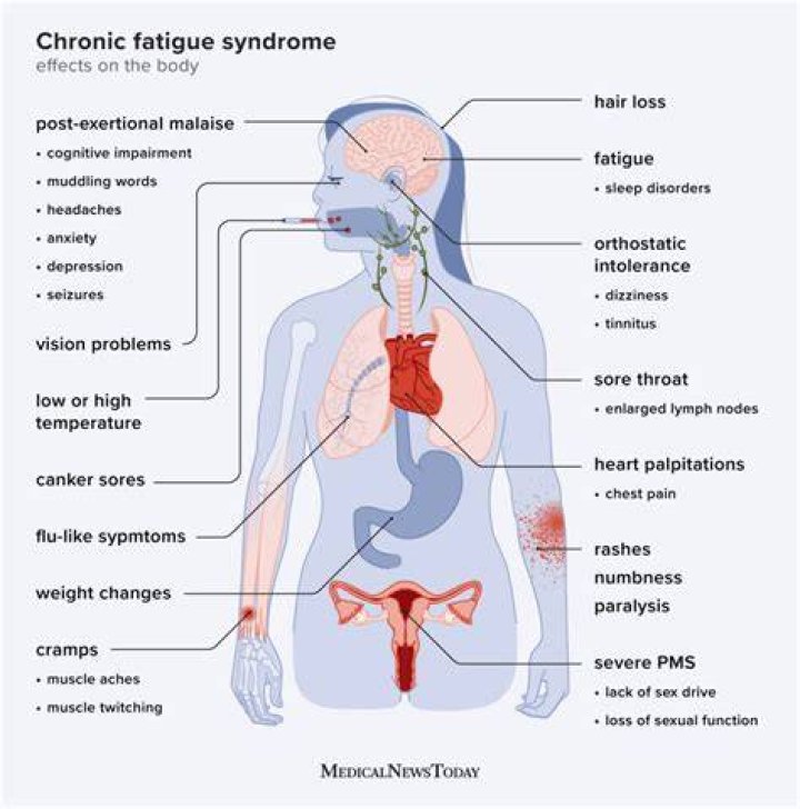 How long does a chronic fatigue flare up last?