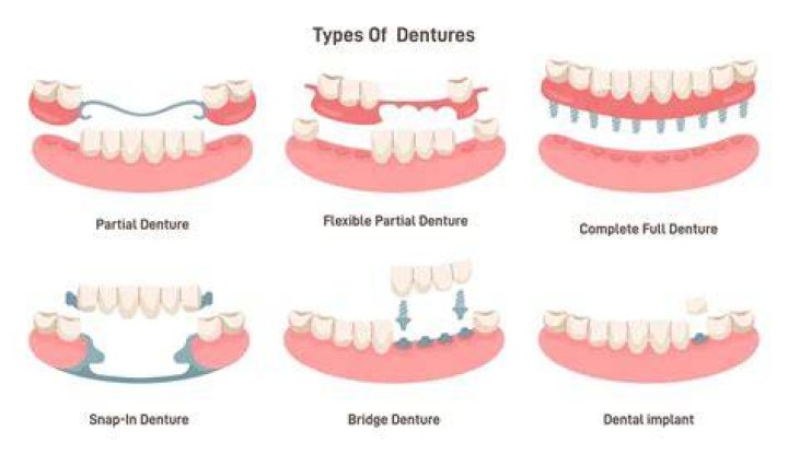 How uncomfortable are dentures?