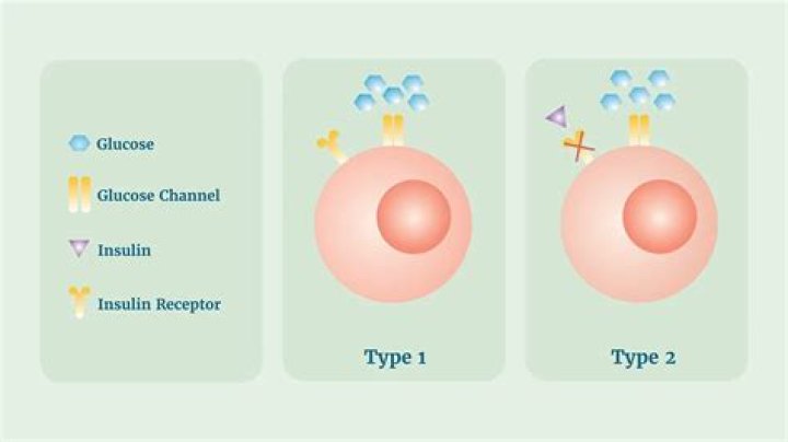 Is diabetes Type 2 a death sentence?