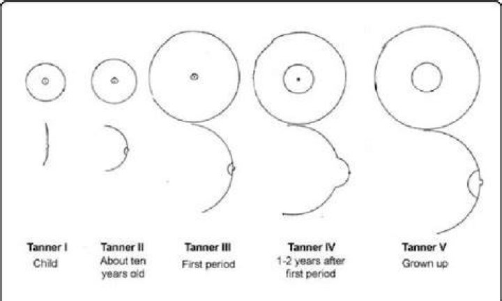 Is it normal for breasts to hurt at 11 years old?
