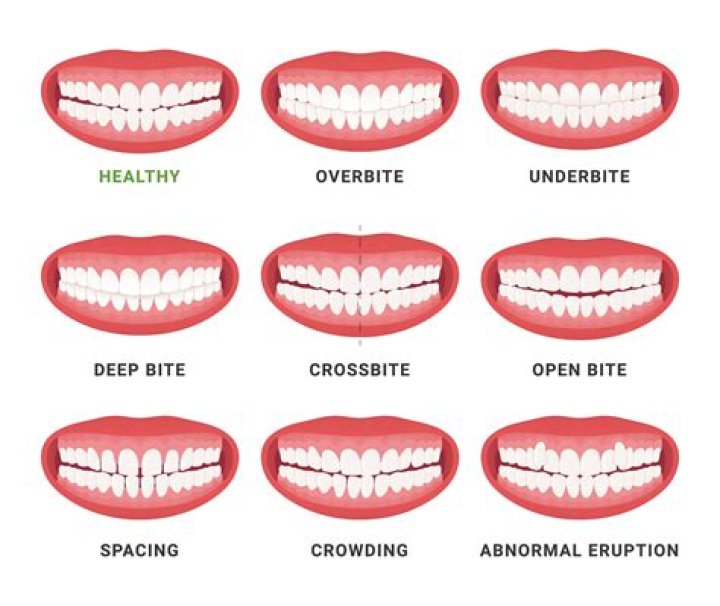 Is it OK to smile with your mouth closed?