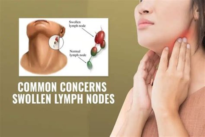 Should I worry about a pea sized lymph node?