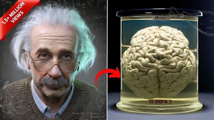 Was Einstein's brain different?