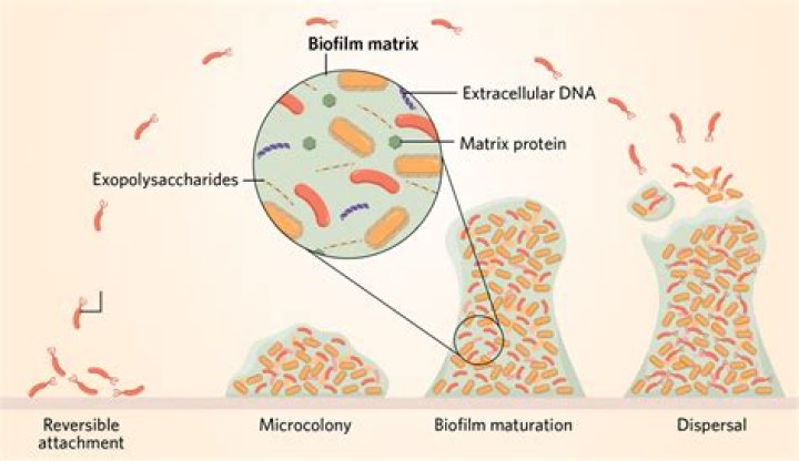 What bacteria causes biofilm?