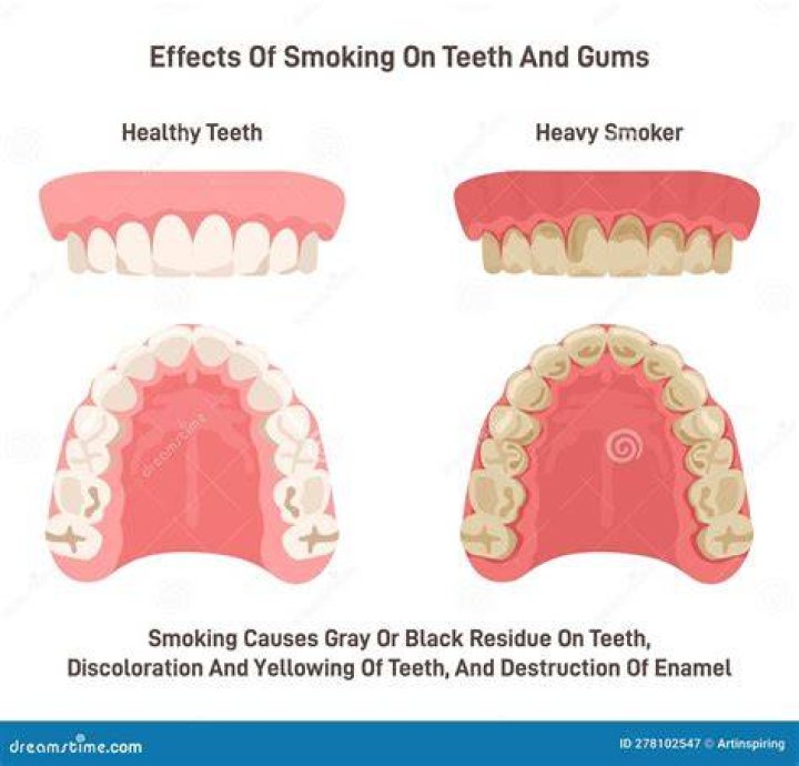What does a smoker's mouth look like?