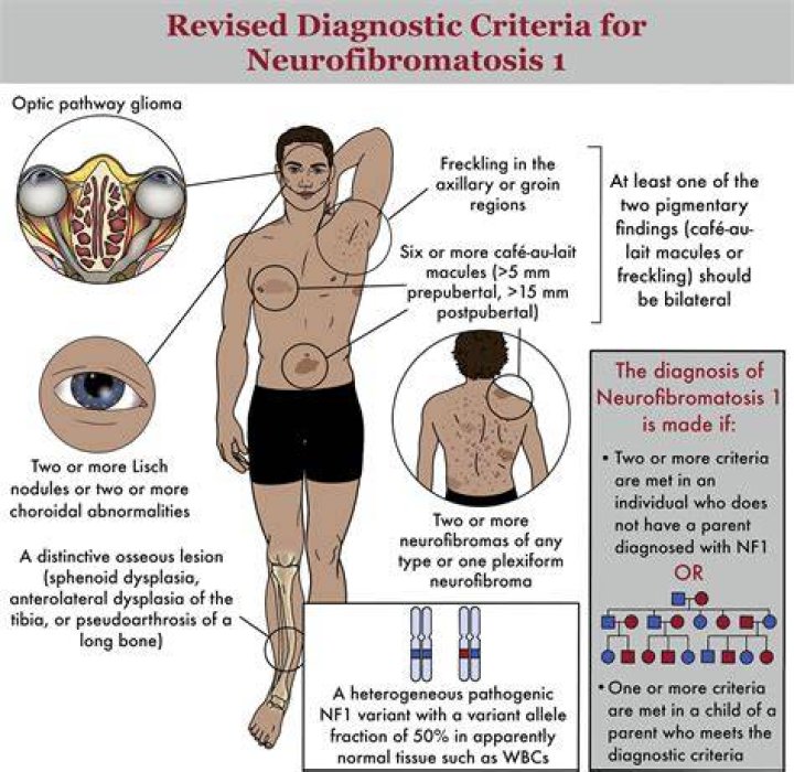 When do NF1 tumors appear?