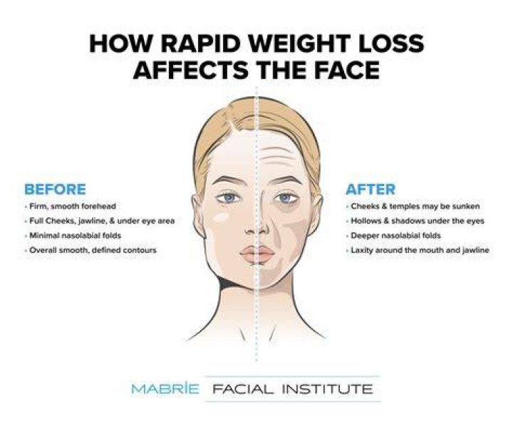 When do you lose weight in your face?