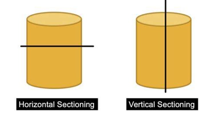 Which is better horizontal or vertical c-section?