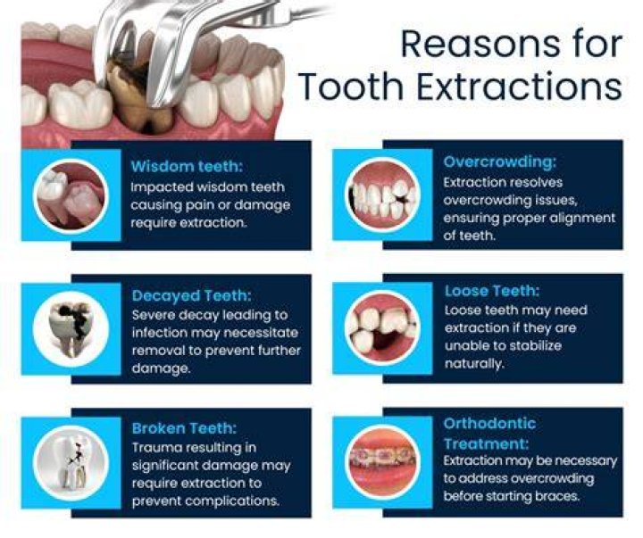 Will extracting a tooth stop the pain?