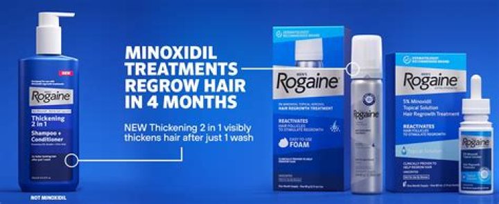 Will Rogaine thicken existing hair?